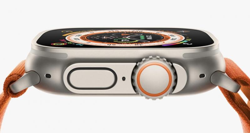 Itt az idő: végre megérkezhet a régóta várt frissítés az Apple okosórákhoz!