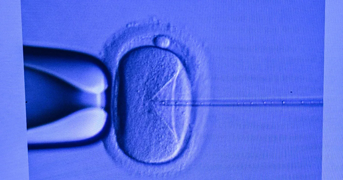 Izraelben egy váratlan eset történt, amikor egy lombikbébi tévedésből másik családhoz került. A bíróság most úgy döntött, hogy a biológiai szülőknek ítéli a gyermeket, ezzel sok kérdést és érzelmet felvetve az érintettek életében.